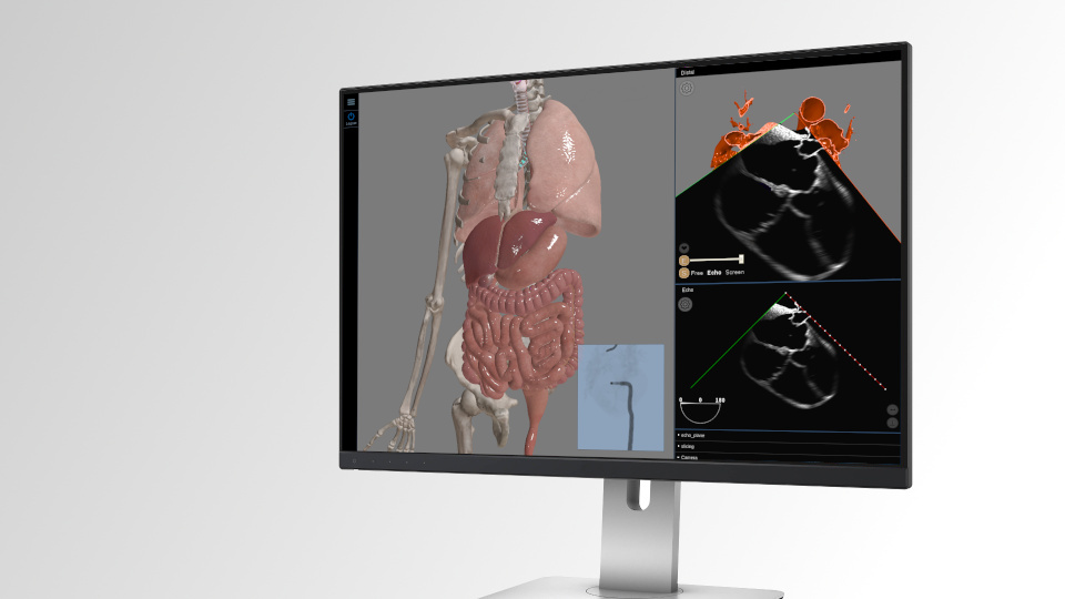 Interactive web-based 3D medical heart surgery simulator